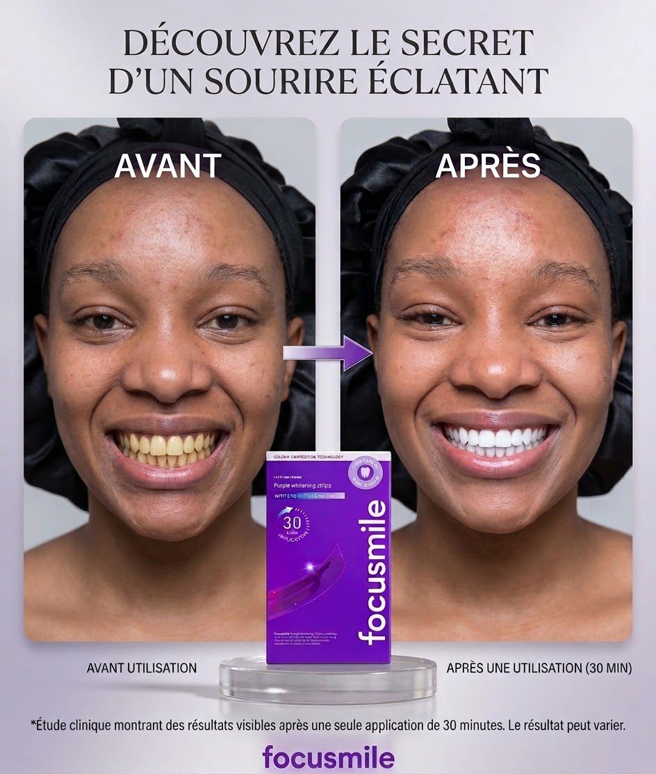 BLANCHISSEMENT DENTAIRE